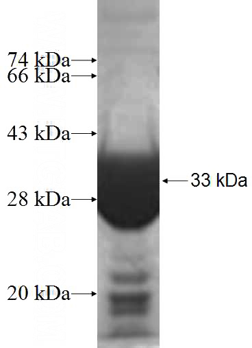 Recombinant Human HSCB SDS-PAGE