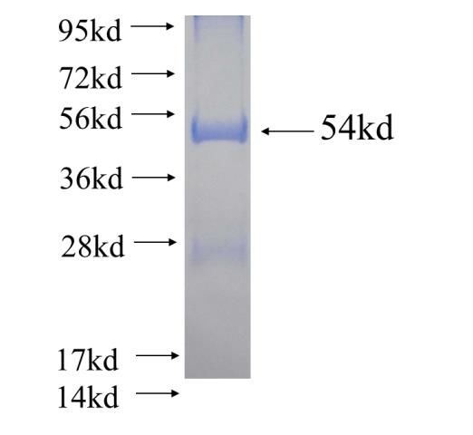 Recombinant human FANCI SDS-PAGE