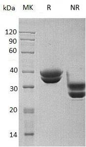 Human GPA33 (His tag) recombinant protein
