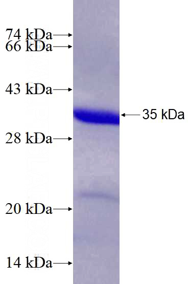 Recombinant Human HFM1 SDS-PAGE
