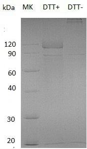 Human IL12RB1/IL12R/IL12RB (Fc tag) recombinant protein