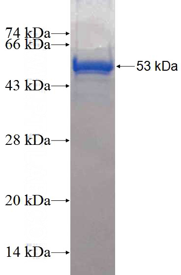 Recombinant Human CCDC85B SDS-PAGE