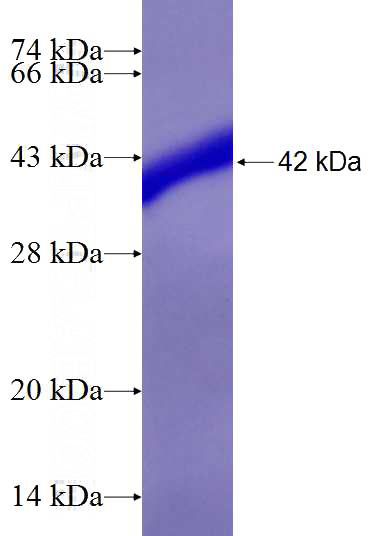 Recombinant Human DPY30 SDS-PAGE