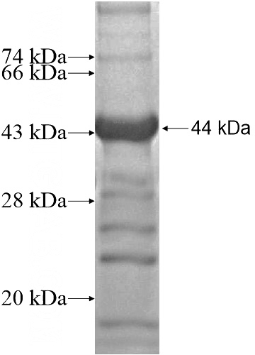 Recombinant Human ZNF232 SDS-PAGE