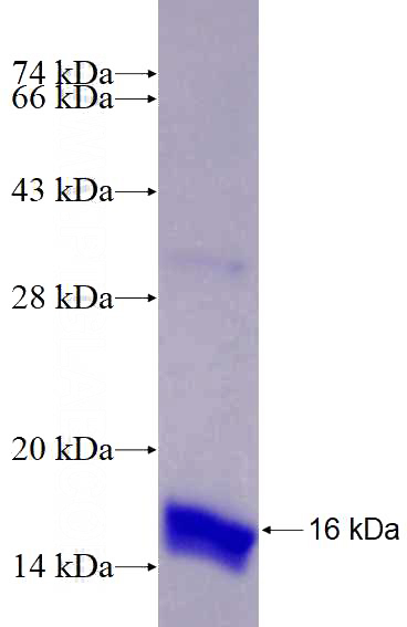 Recombinant Human RAB43 SDS-PAGE