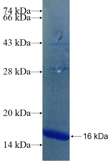 Human ACC Recombinant protein (6*His tag)