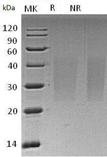 Human CD99L2/MIC2L1/UNQ1964/PRO4486 (His tag) recombinant protein