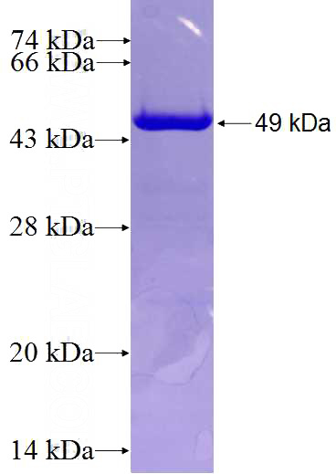 Recombinant Human TTL SDS-PAGE