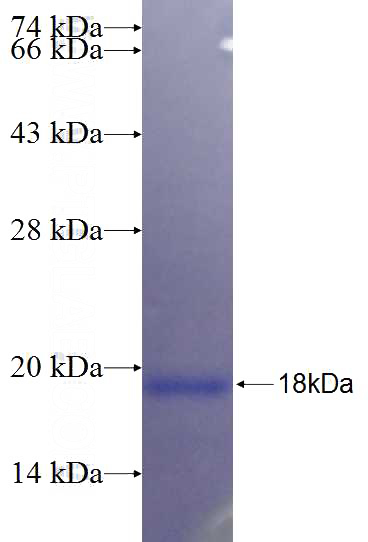 Recombinant Human YIPF1 SDS-PAGE