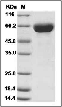 Human Hexosaminidase B / HEXB Protein (His Tag) SDS-PAGE
