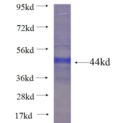 Recombinant human ACADVL SDS-PAGE