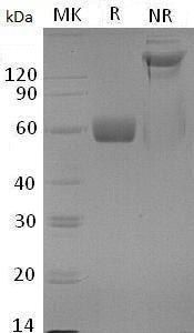 Mouse Tgfbr2 (Fc tag) recombinant protein