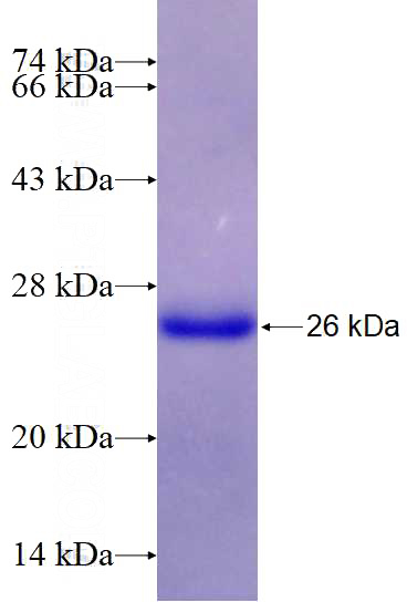 Recombinant Human CDX2 SDS-PAGE