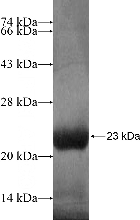 Recombinant Human LMBRD2 SDS-PAGE