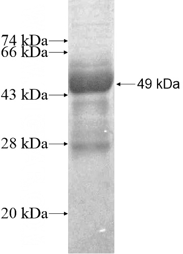 Recombinant Human ARFRP1 SDS-PAGE