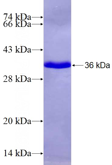 Recombinant Human KTI12 SDS-PAGE