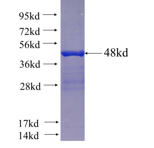 Recombinant human KIAA1109 SDS-PAGE