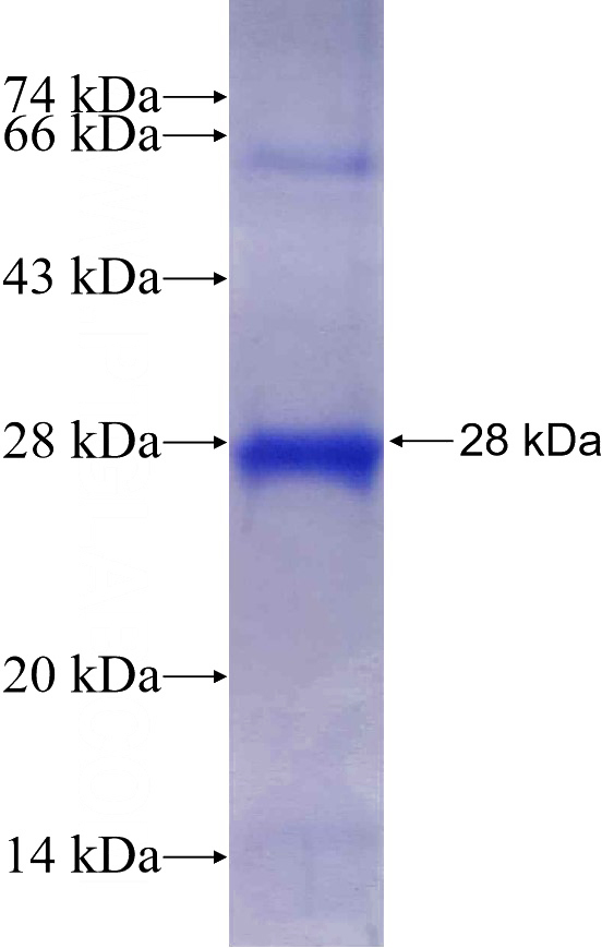 Recombinant Human SIRT7 SDS-PAGE