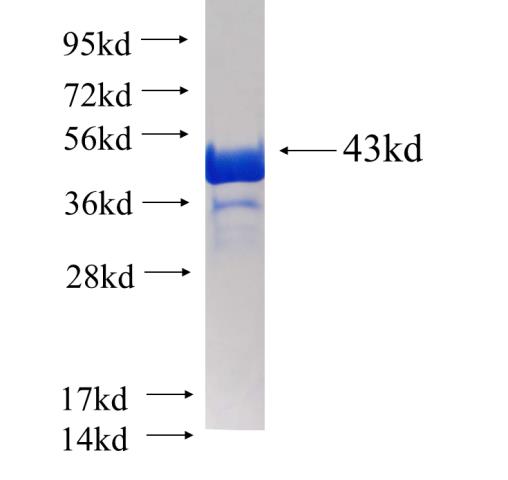 Recombinant human CALML4 SDS-PAGE