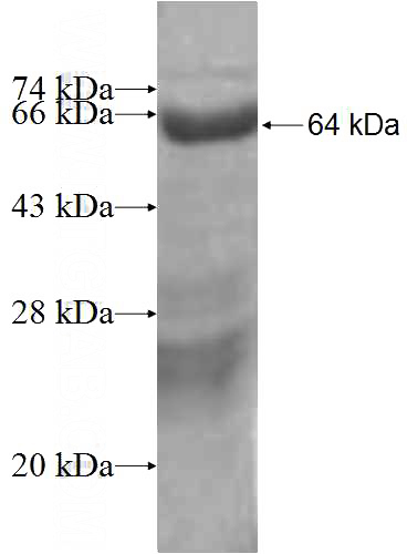 Recombinant Human RIMS2 SDS-PAGE