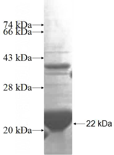 Recombinant Human STARD4 SDS-PAGE