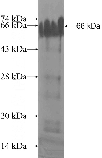 Recombinant Human MUM1L1 SDS-PAGE