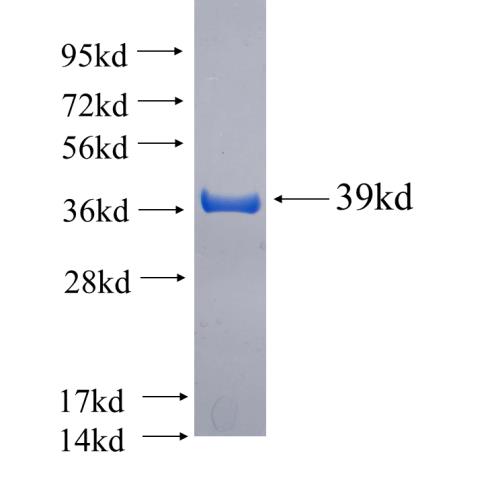 Recombinant human CCT4 SDS-PAGE