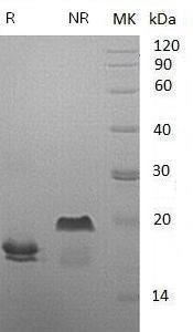 Human PLA2G1B/PLA2/PLA2A/PPLA2 (His tag) recombinant protein