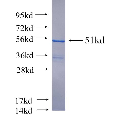 Recombinant human SNX18 SDS-PAGE