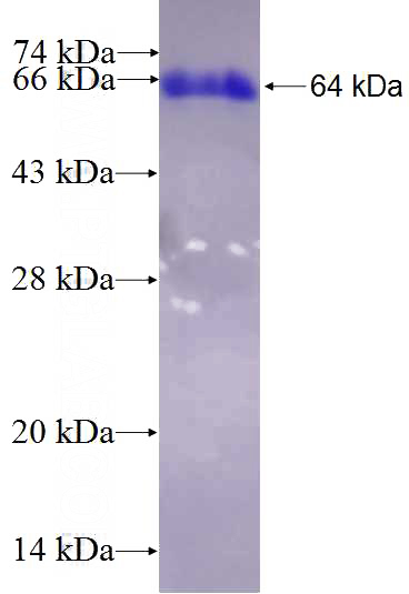 Recombinant Human ARMC9 SDS-PAGE
