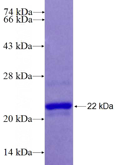 Recombinant Human ZNF570 SDS-PAGE