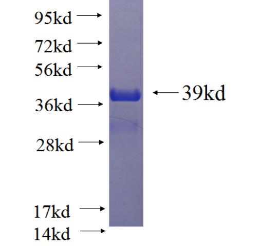 Recombinant human VAMP2 SDS-PAGE