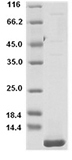 Human IGF1/IGF‑I/IGF-1 Protein 15913