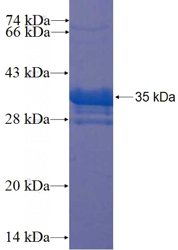 Recombinant Human PCDHB14 SDS-PAGE