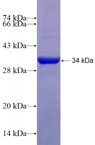 Recombinant Human SLC25A46 SDS-PAGE