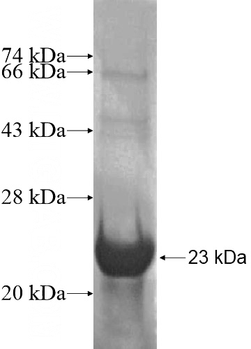 Recombinant Human ZSCAN16 SDS-PAGE