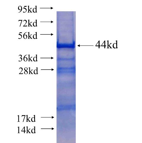 Recombinant human ZHX2 SDS-PAGE