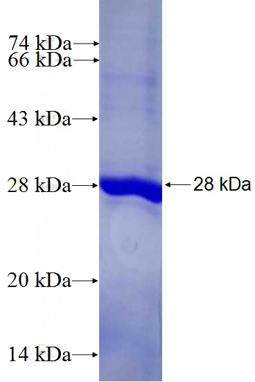Recombinant Human PDE6B SDS-PAGE