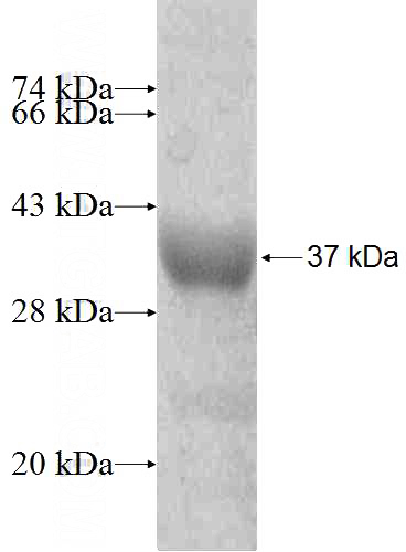 Recombinant Human GLYATL1 SDS-PAGE