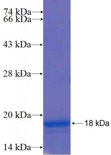 Recombinant Human GABARAPL2 SDS-PAGE