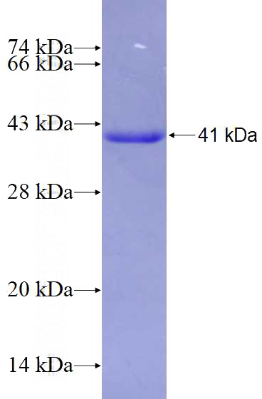 Recombinant Human RAI2 SDS-PAGE