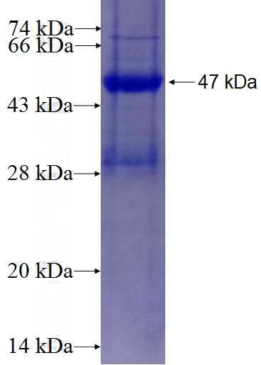 Recombinant Human ESRRG SDS-PAGE