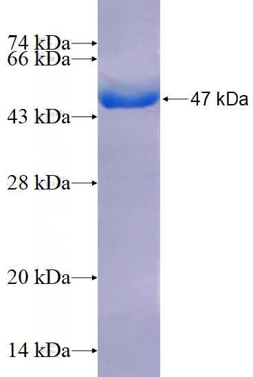 Recombinant Human RARS SDS-PAGE