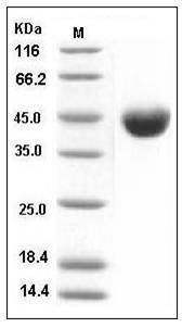 Mouse CD112 / Nectin-2 / PVRL2 Protein (His Tag) SDS-PAGE