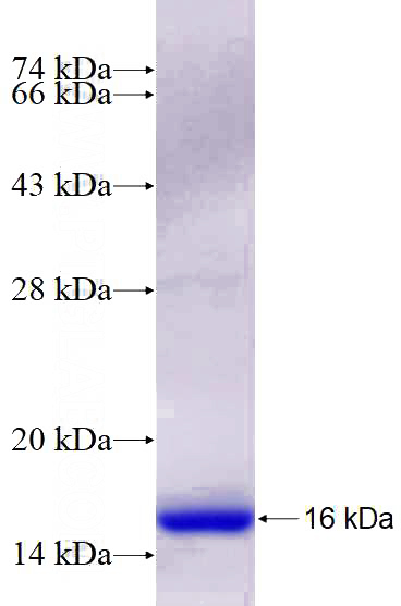 Recombinant Human SOCS1 SDS-PAGE