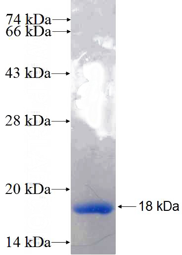 Recombinant Human MORN4 SDS-PAGE