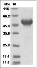 Human NTNG1 / Netrin-G1 Protein (His Tag) SDS-PAGE