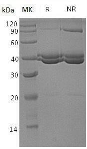 Human SUMF1/FGE/PSEC0152/UNQ3037/PRO9852 (His tag) recombinant protein