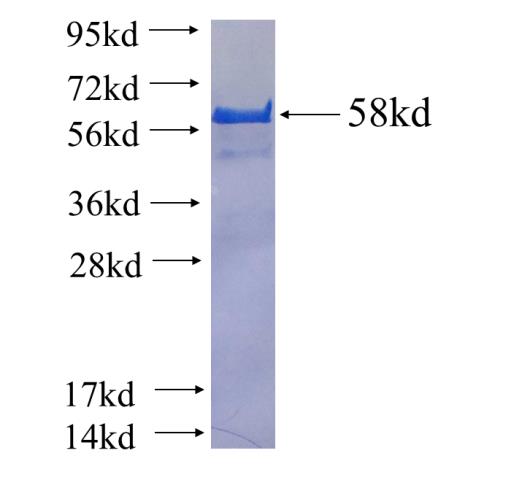 Recombinant human SMC4 SDS-PAGE