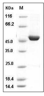 Mouse KYNU / Kynureninase Protein (His Tag) SDS-PAGE